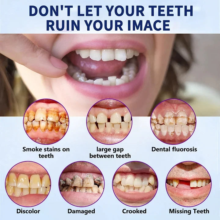 Complete Denture Set — Eat, Smile & Speak with Confidence