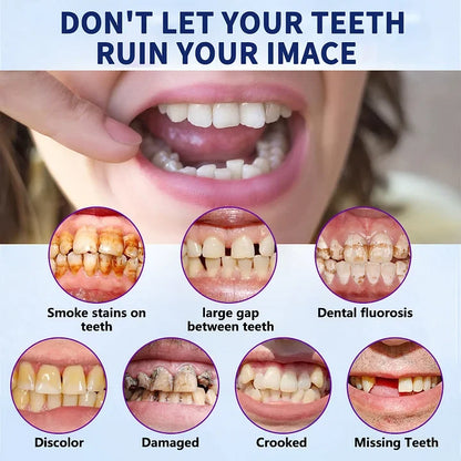 Complete Denture Set — Eat, Smile & Speak with Confidence
