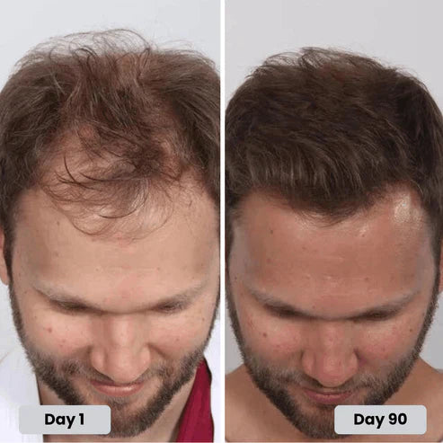 Red Light Therapy Cap for Hair Regrowth Treatment