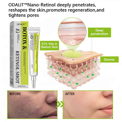 Botox & Retinol Shot - Eraser for Deep Wrinkles, Sagging Jowls & Puffy Eyes