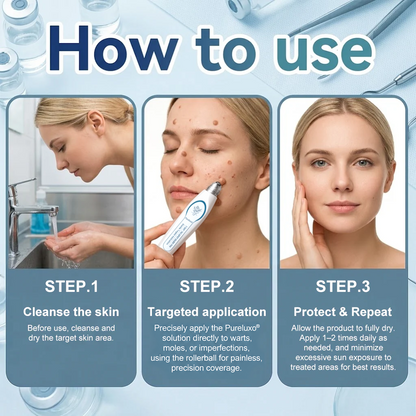 Myblexy® Skin Tag Remover Roller💥💥💥