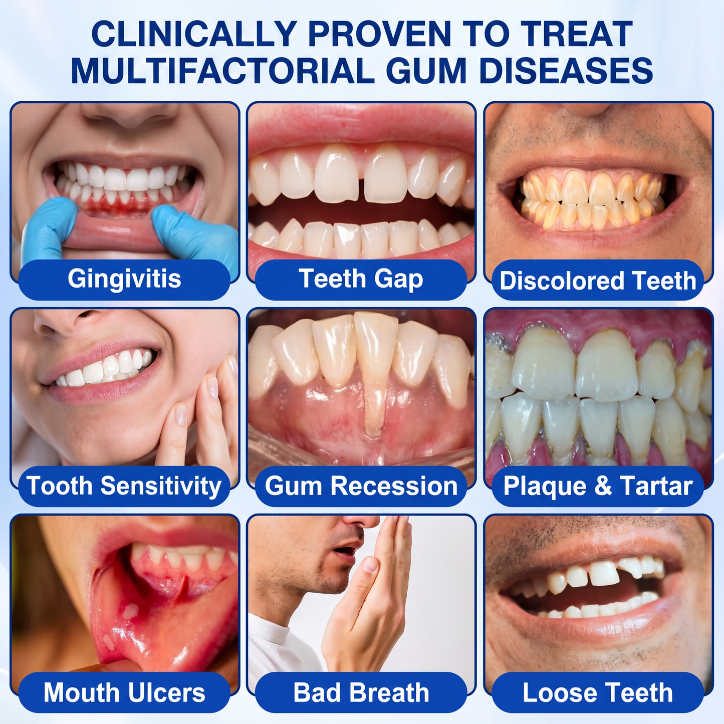 Myblexy® 🦷GumRevive periodontal repair gel🌿🌿🌿