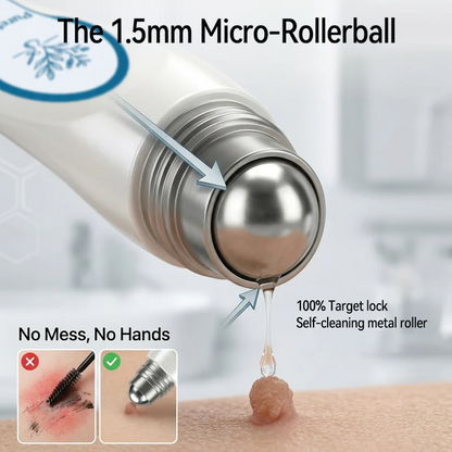 Myblexy® Skin Tag Remover Roller💥💥💥