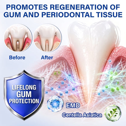 Myblexy® 🦷GumRevive periodontal repair gel🌿🌿🌿