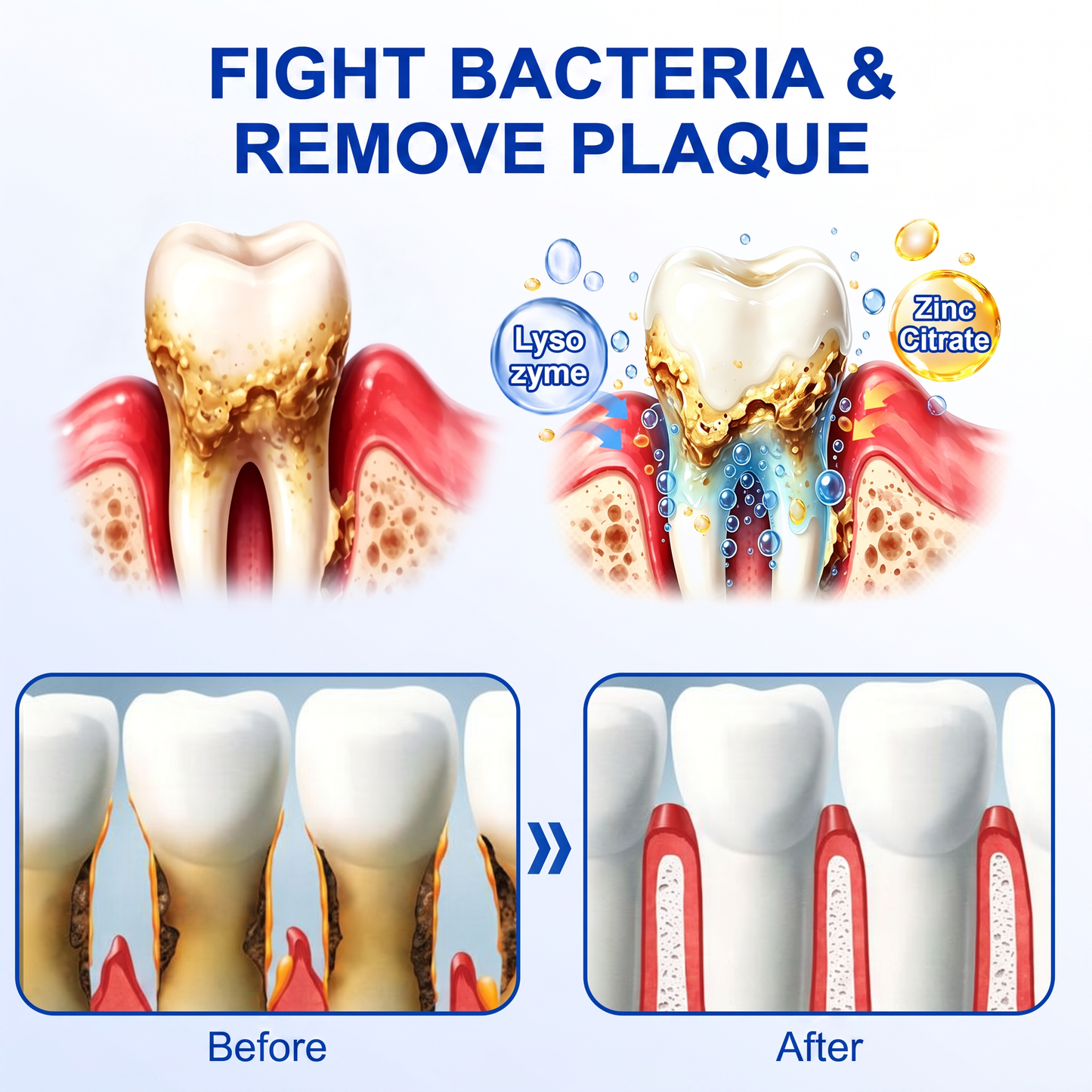 Myblexy® 🦷GumRevive periodontal repair gel🌿🌿🌿