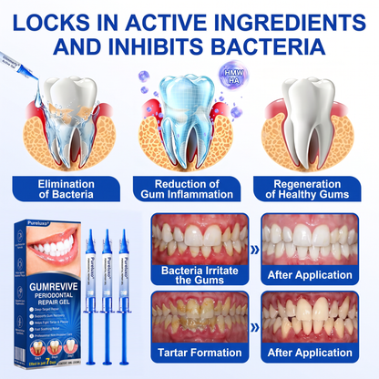 Myblexy® 🦷GumRevive periodontal repair gel🌿🌿🌿