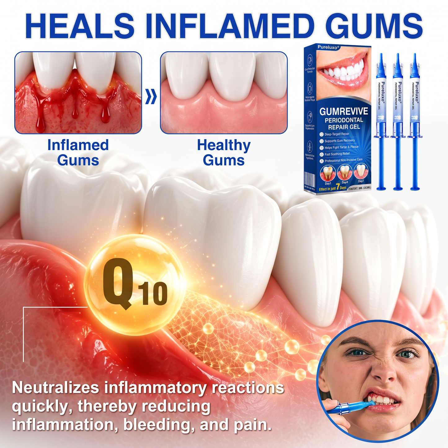 Myblexy® 🦷GumRevive periodontal repair gel🌿🌿🌿
