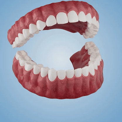 Complete Denture Set — Eat, Smile & Speak with Confidence