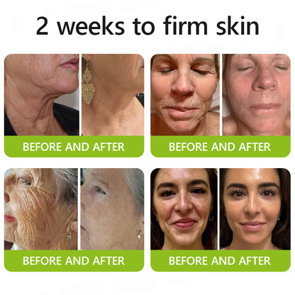 Botox & Retinol Shot - Eraser for Deep Wrinkles, Sagging Jowls & Puffy Eyes