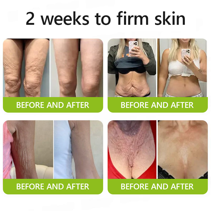 Botox & Retinol Shot - Eraser for Deep Wrinkles, Sagging Jowls & Puffy Eyes