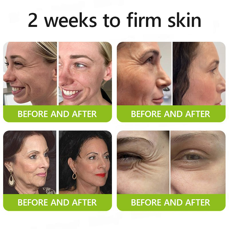 Botox & Retinol Shot - Eraser for Deep Wrinkles, Sagging Jowls & Puffy Eyes