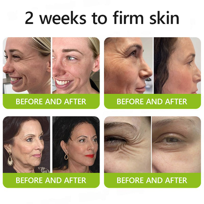 Botox & Retinol Shot - Eraser for Deep Wrinkles, Sagging Jowls & Puffy Eyes