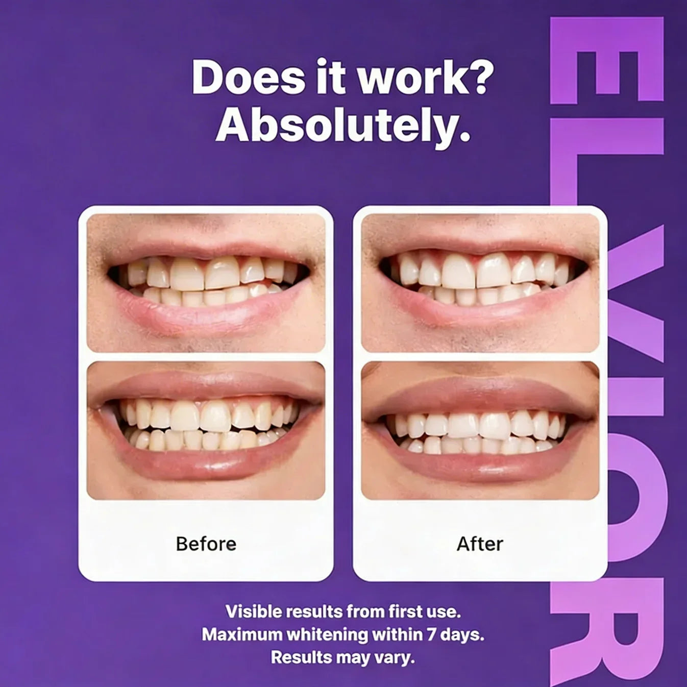 DrDent™ Purple Strips — Brighten Your Smile. Boost Your Confidence.