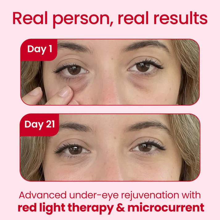 Ravlumi Red Light Therapy Glasses — Rechargeable Eye Relief